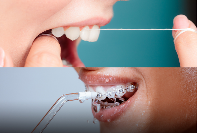 Water Flosser Vs. String Floss Which One Is Better? Fly Cat